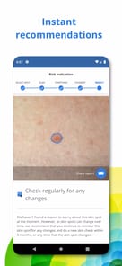 SkinVision APK screenshot 1