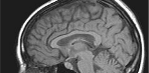 install MRI Viewer on PC