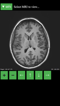 MRI Viewer APK screenshot 1