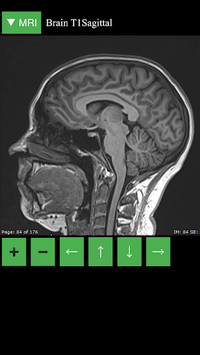 MRI Viewer APK screenshot 1