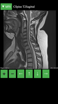 MRI Viewer APK screenshot 1